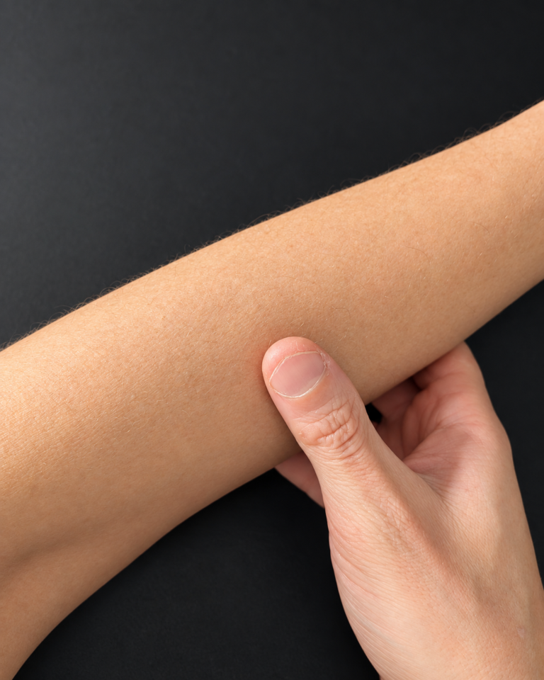 Opposite thumb and fingers making contact with the fleshy forearm.
